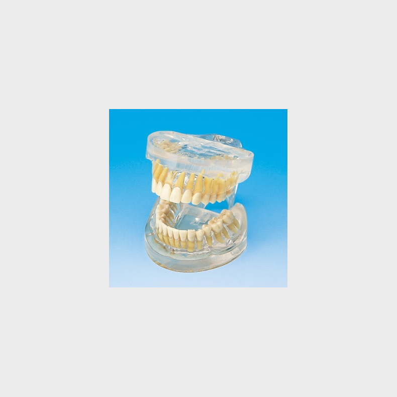 Transparent Kbemodel med Tnder 